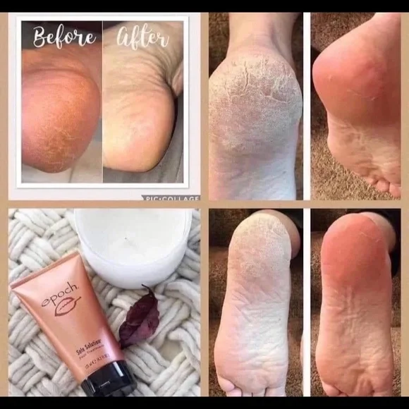 - (2) TWO Epoch NuSkin Sole Solution foot treatment